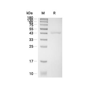 SORD蛋白, Human (HEK293, His)