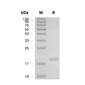 Troponin C/TNNC1蛋白, Human (His, solution)