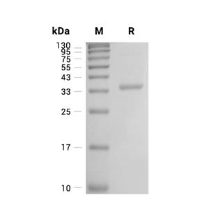 TRIM5蛋白, Human (His),TRIM5 Protein, Human (His)