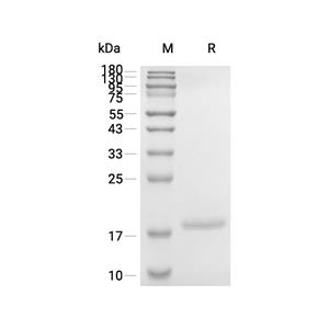 IL-1 beta蛋白, Human (solution),IL-1 beta Protein, Human (solution)