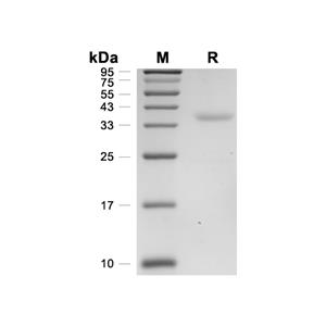 ZWINT/ZW10 interactor蛋白, Human (His)