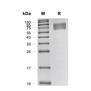 IL-15R alpha蛋白, Mouse (HEK293, hFc)