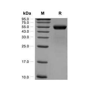 ROR2蛋白, Human (HEK293, His)