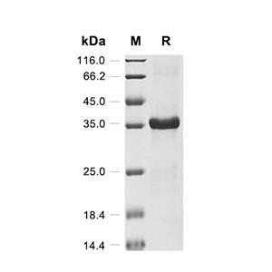 CLEC4C蛋白, Human (His-SUMO),CLEC4C Protein, Human (His-SUMO)