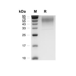 IL-17RD蛋白, Mouse (CHO)