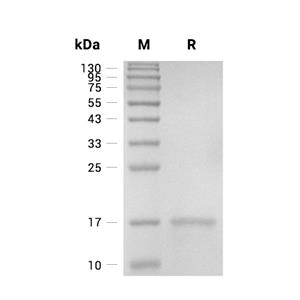 TECK/CCL25蛋白, Mouse