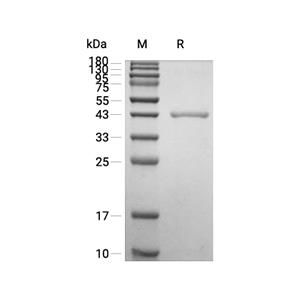 PPID蛋白, Human (His, solution)