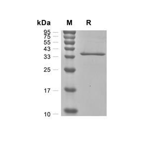 Tenascin/Tnc蛋白, Human (His)