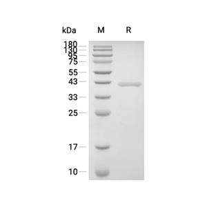OGG1蛋白, Human (His)