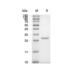 PRDX1/Peroxiredoxin-1蛋白, Human (His),PRDX1/Peroxiredoxin-1 Protein, Human (His)