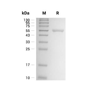 ATP5F1A蛋白, Human (His)