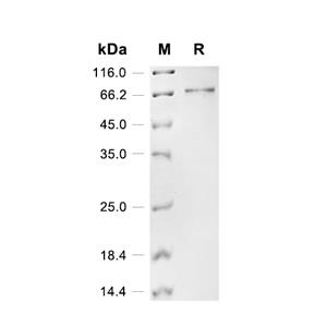 Wilms tumor蛋白/WT1蛋白, Human (His-SUMO)