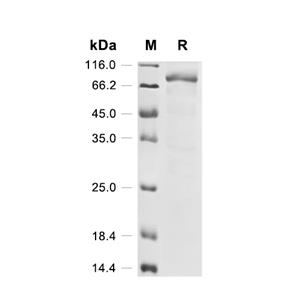Histone deacetylase 1/HDAC1蛋白, Human (His-SUMO),Histone deacetylase 1/HDAC1 Protein, Human (His-SUMO)