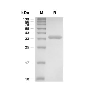 Outer membrane蛋白 A/OmpA蛋白, E.coli (His-SUMO)