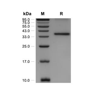 FGF-15蛋白, Mouse (His-SUMO)