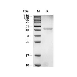 PPM1A蛋白, Human (His),PPM1A Protein, Human (His)