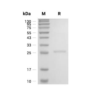 C1QTNF3/CTRP3蛋白, Human (His)