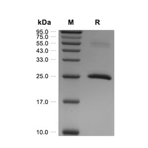 COMT蛋白, Human (His)