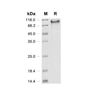 Toll-like receptor 8/TLR8蛋白, Human (P.pastoris, His)