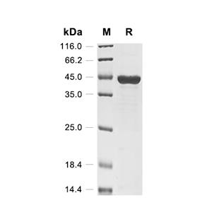 Outer membrane porin F/OmpF蛋白, E.coli (His, Myc)