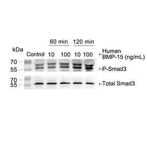 BMP-15蛋白, Human (His, Myc)