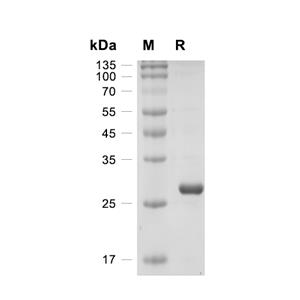 GFP蛋白, Aequorea victoria (His)