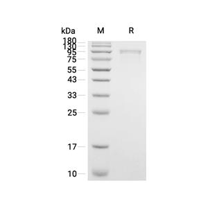 Semaphorin-3F/SEMA3F蛋白, Human (HEK293, His-Myc),Semaphorin-3F/SEMA3F Protein, Human (HEK293, His-Myc)