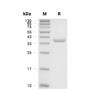 Annexin A1/ANXA1蛋白, Mouse (His)
