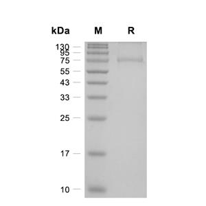 PNPLA2蛋白, Human (His-SUMO)