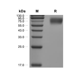 TrkB蛋白, Mouse (HEK293, His),TrkB Protein, Mouse (HEK293, His)