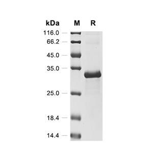 Inhibin alpha chain/INHA蛋白, Bovine (His-SUMO)