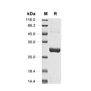 NUP210蛋白, Human (His)