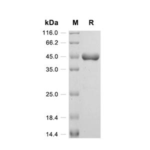Outer membrane porin C/OmpC蛋白, Klebsiella pneumoniae (His, Myc),Outer membrane porin C/OmpC Protein, Klebsiella pneumoniae (His, Myc)