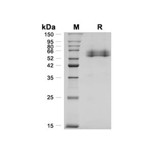 OLFM4蛋白, Human (HEK293, His),OLFM4 Protein, Human (HEK293, His)