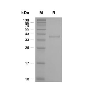 SCGB3A2蛋白, Mouse (His, GST)