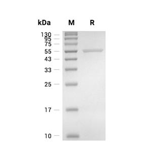 CYP51蛋白, Mycobacterium tuberculosis (sf9, His)