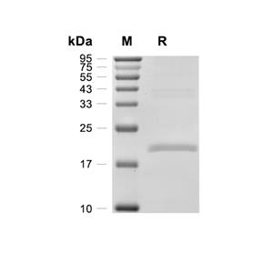 ATP5D蛋白, Human (His)