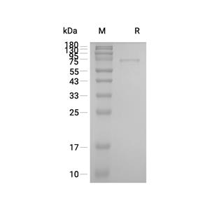 EEF1A1蛋白, Human (His-SUMO),EEF1A1 Protein, Human (His-SUMO)