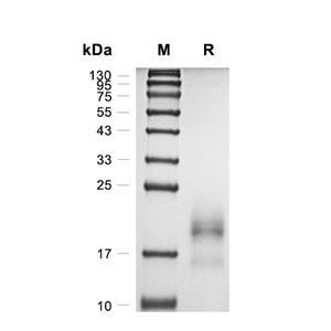 GSTP1蛋白, Rat (His),GSTP1 Protein, Rat (His)