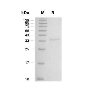 HAS2蛋白, Mouse (His)
