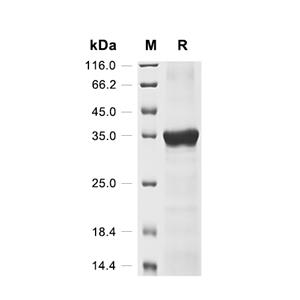 Cathepsin W/CTSW蛋白, Mouse (His, Myc)