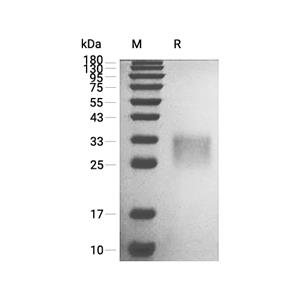 IFN-beta蛋白, Mouse (HEK293)