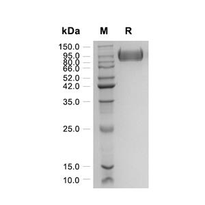 Fibronectin蛋白, Human (HEK293, His)