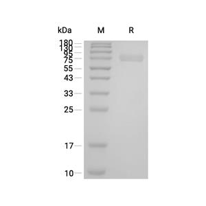DKK-1蛋白, Human (HEK293, Fc),DKK-1 Protein, Human (HEK293, Fc)