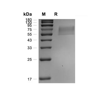Fractalkine/CX3CL1蛋白, Mouse (HEK293, His),Fractalkine/CX3CL1 Protein, Mouse (HEK293, His)