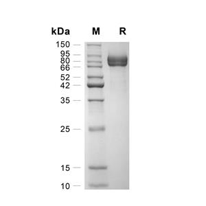 MMP-9蛋白, Human (HEK293)