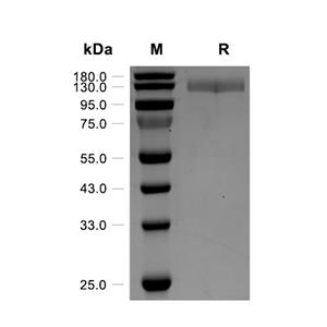 VCAM-1/CD106蛋白, Human (HEK293, Fc)