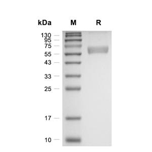 IFN-beta蛋白, Mouse (HEK293, Fc),IFN-beta Protein, Mouse (HEK293, Fc)