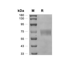BACE1蛋白, Mouse (HEK293, His)
