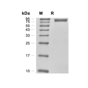 Biotinidase/BTD蛋白, Human (HEK293, His)